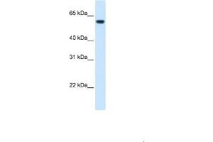 WB Suggested Anti-FTCD Antibody  Titration: 1. (FTCD 抗体  (N-Term))