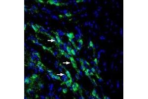 Expression of SLC6A14 in mouse RTN - Immunohistochemical staining of perfusion-fixed frozen mouse brain sections with Anti-SLC6A14 (extracellular) Antibody (ABIN7043737, ABIN7044477 and ABIN7044478), (1:200), followed by goat-anti-rabbit-AlexaFluor-488.