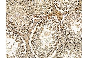 ABIN7096114 and ABIN7100176 at 1/100 staining rat testis tissue by IHC-P. (PYM 抗体)