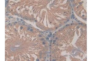 Immunohistochemistry (IHC) image for anti-Lactoperoxidase (LPO) (AA 351-589) antibody (ABIN7437911)