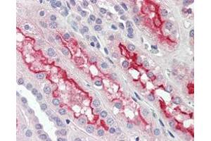 Immunohistochemical analysis of paraffin-embedded human kidney tissues using FER mouse mAb. (FER 抗体)