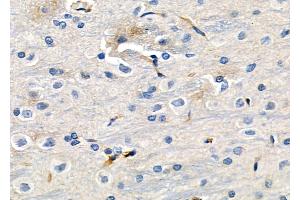 ABIN6257242 and ABIN6273630 at 1/100 staining Rat brain tissue by IHC-P. (GRIP1 抗体  (Internal Region))