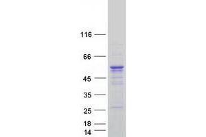 Western Blotting (WB) image for Cytoplasmic Polyadenylation Element Binding Protein 1 (CPEB1) (Transcript Variant 3) protein (Myc-DYKDDDDK Tag) (ABIN2712529)