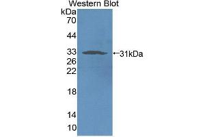 Western blot analysis of recombinant Rat NCR1. (NCR1 抗体  (AA 17-258))