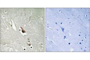 Immunohistochemistry analysis of paraffin-embedded human brain, using MAP3K7 (Phospho-Ser439) Antibody.