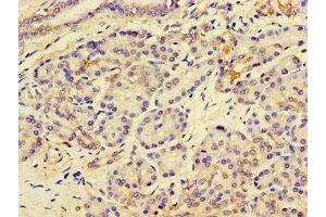 Immunohistochemistry of paraffin-embedded human pancreatic tissue using ABIN7158760 at dilution of 1:100 (LPCAT3 抗体  (AA 306-363))
