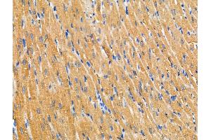 ABIN6257638 and ABIN6274781 at 1/100 staining Rat heart tissue by IHC-P.