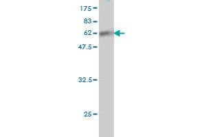 Western Blot detection against Immunogen (61. (SUPT3H/SPT3 抗体  (AA 1-328))