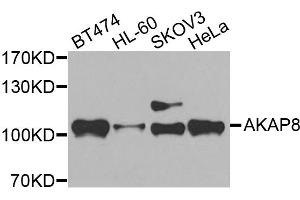 Western blot analysis of extracts of various cell lines, using AKAP8 antibody (ABIN5975842) at 1/500 dilution. (AKAP8 抗体)
