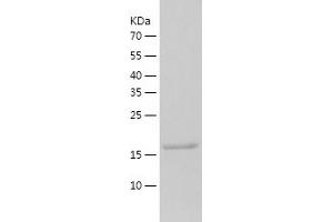 Western Blotting (WB) image for Ubiquitin-Conjugating Enzyme E2H (UBE2H) (AA 1-183) protein (His tag) (ABIN7286685) (UBE2H Protein (AA 1-183) (His tag))