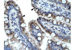 WB Suggested Anti-KRT15 Antibody Titration: 4. (KRT15 抗体  (C-Term))