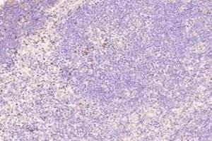 Immunohistochemistry analysis of paraffin-embedded mouse thymus using,TOX(ABIN7075899) at dilution of 1: 4000
