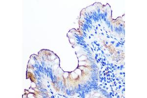 Immunohistochemistry of paraffin-embedded human appendix using CE Rabbit mAb (ABIN7266083) at dilution of 1:100 (40x lens). (CEACAM1 抗体)