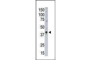 Image no. 1 for anti-Melanoma Antigen Family A, 9 (MAGEA9) (Middle Region) antibody (ABIN358651) (MAGEA9 抗体  (Middle Region))