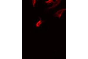 ABIN6275874 staining COLO205 by IF/ICC. (LY75/DEC-205 抗体  (Internal Region))