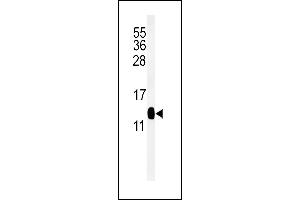 Western blot analysis of DC13 Antibody (N-term) (ABIN651108 and ABIN2840074) in mouse kidney tissue lysates (35 μg/lane). (C16orf61 抗体  (N-Term))