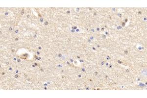 Detection of ANXA5 in Bovine Cerebrum Tissue using Polyclonal Antibody to Annexin V (ANXA5) (Annexin V 抗体  (AA 1-321))