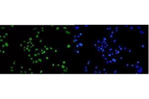 IF analysis of TPR using anti-TPR antibody (ABIN7603243). (TPR 抗体  (N-Term))