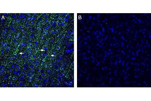 Expression of Vasopressin V1A Receptor in rat frontal cortex. (AVPR1A 抗体  (Intracellular))
