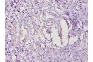 Immunohistochemistry of paraffin-embedded human kidney tissue using ABIN7173071 at dilution of 1:100 (TMEM14B 抗体  (AA 1-114))