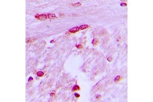 Immunohistochemical analysis of BTF3L4 staining in human brain formalin fixed paraffin embedded tissue section. (BTF3L4 抗体  (Center))