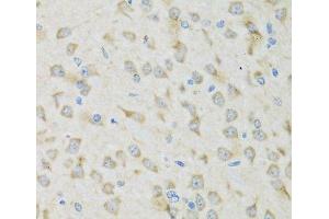 Immunohistochemistry of paraffin-embedded Mouse brain using CLCN7 Polyclonal Antibody at dilution of 1:100 (40x lens). (CLCN7 抗体)