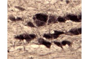IHC on rat trigeminal nerve (free floating cryo section) using rabbit SORT1 polyclonal antibody  at a dilution of 1 : 1000. (Sortilin 1 抗体)
