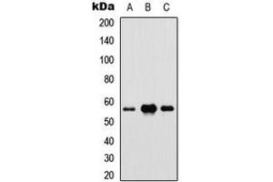 Western blot analysis of IRF5 expression in HEK293T (A), Raw264. (IRF5 抗体  (Center))