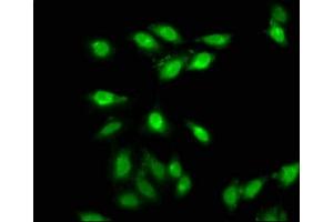 Immunofluorescence staining of Hela cells with ABIN7144009 at 1:66, counter-stained with DAPI. (AMMECR1 抗体  (AA 146-248))