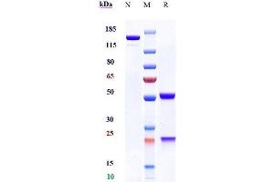 Anti - Human/Mouse CD100( Pepinemab) on SDS-PAGE under reducing (R) condition. (Recombinant SEMA4D (Pepinemab Biosimilar) 抗体)
