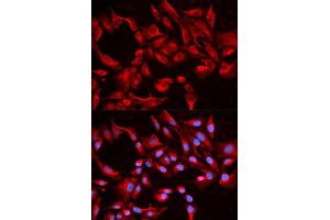 Immunofluorescence analysis of HeLa cells using BCL2L13 antibody (ABIN5970460). (BCL2L13 抗体)
