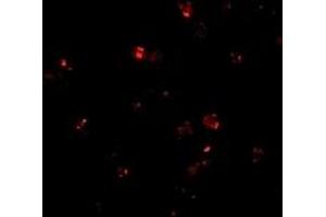 Immunofluorescence (IF) image for anti-Presenilin Enhancer 2 Homolog (PSENEN) (C-Term) antibody (ABIN1030574) (PEN2 抗体  (C-Term))
