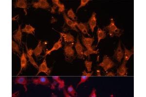 Immunofluorescence analysis of C6 cells using HSD17B1 Polyclonal Antibody at dilution of 1:100 (40x lens). (HSD17B1 抗体)