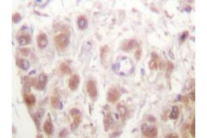 Immunohistochemistry analyzes of Rad52 antibody in paraffin-embedded human testis tissue. (RAD52 抗体)