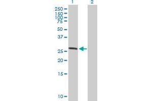Western Blot analysis of ASB7 expression in transfected 293T cell line by ASB7 MaxPab polyclonal antibody. (ASB7 抗体  (AA 1-274))