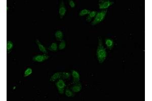 Immunofluorescence staining of HepG2 cells with ABIN7164247 at 1:100, counter-stained with DAPI. (Lamin A/C 抗体  (AA 385-572))