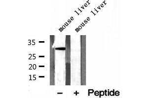 Western blot analysis of extracts of mouse liver tissue, using GNMT antibody. (GNMT 抗体  (Internal Region))