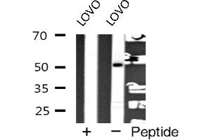 Western blot analysis of hnRNP K expression in LOVO cells (HNRNPK 抗体  (Internal Region))