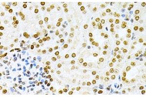 Immunohistochemistry of paraffin-embedded Mouse kidney using DKC1 Polyclonal Antibody at dilution of 1:200 (40x lens). (DKC1 抗体)