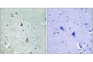 Immunohistochemistry analysis of paraffin-embedded human brain, using B-RAF (Phospho-Ser446) Antibody. (SNRPE 抗体  (pSer446))
