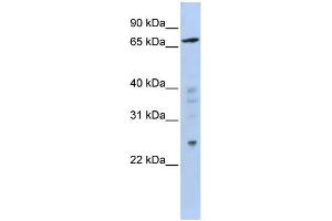 WB Suggested Anti-ZNF510 Antibody Titration:  0. (ZNF510 抗体  (Middle Region))