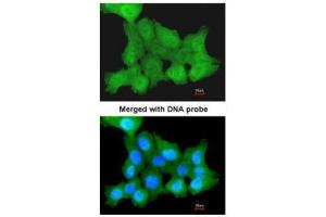 ICC/IF Image Immunofluorescence analysis of paraformaldehyde-fixed A431, using ZNF259, antibody at 1:200 dilution. (ZNF259 抗体  (Center))