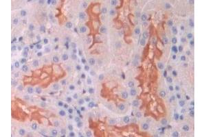 Detection of ENG in Rat Kidney Tissue using Polyclonal Antibody to Endoglin (ENG)