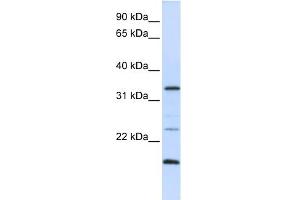 WB Suggested Anti-ARGFX Antibody Titration:  0. (ARGFX 抗体  (N-Term))