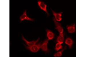 ABIN6276168 staining HeLa by IF/ICC. (OR5F1 抗体  (C-Term))