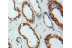 Used in DAB staining on fromalin fixed paraffin-embedded Kidney tissue (PEX2 抗体  (AA 28-118))