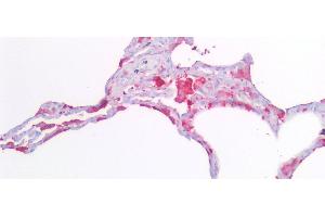 Immunohistochemistry (IHC) image for anti-Ferritin, Light Polypeptide (FTL) (AA 2-175) antibody (ABIN7435310)