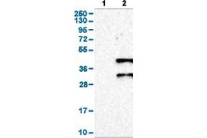 Western Blot analysis of (1) Negative control (vector only transfected HEK293T lysate), and (2) Over-expression lysate (Co-expressed with a C-terminal myc-DDK tag (~3. (DAZL 抗体  (AA 169-231))