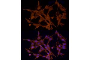 Immunofluorescence (IF) image for anti-serine/threonine Kinase 24 (STK24) (AA 312-431) antibody (ABIN6148602)