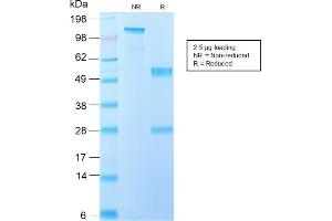 SDS-PAGE Analysis Purified IL-10 Recombinant Rabbit Monoclonal Antibody (IL10/2651R). (Recombinant IL-10 抗体)